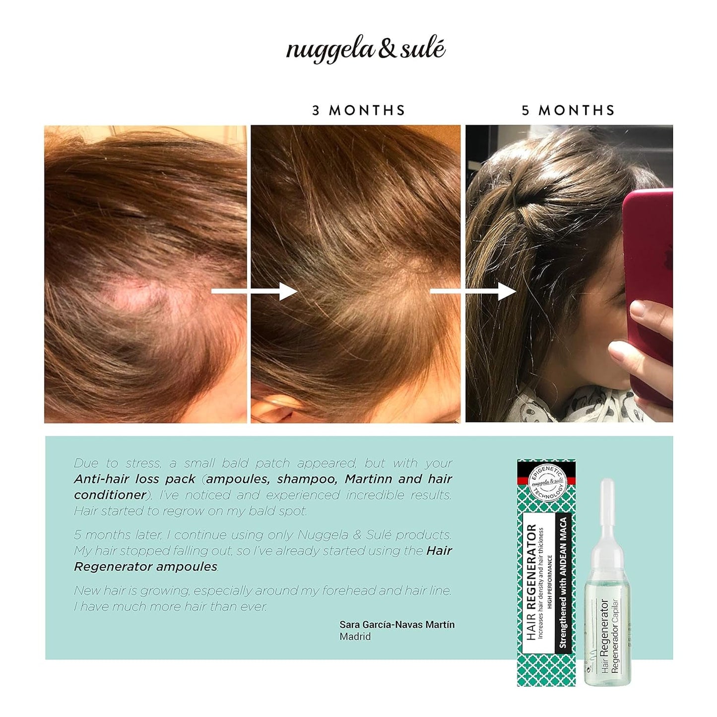 Nuggela & Sulé Ampollas acondicionadoras para el cabello, aumenta la densidad y fuerza del cabello Cuidado del cabello Nuggela