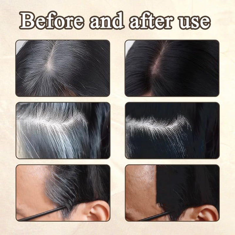 2 Piezas de Polvo de Rayita Marrón Oscuro, Polvo de Rayita, Corrector de Rayita, Lápices de Color de Cabello con Peine, Herramienta para Cobertura de Cabello Gris para Mujeres y Hombres (40 g, Marrón Oscuro) Naty Shop Tinte para el Cabello