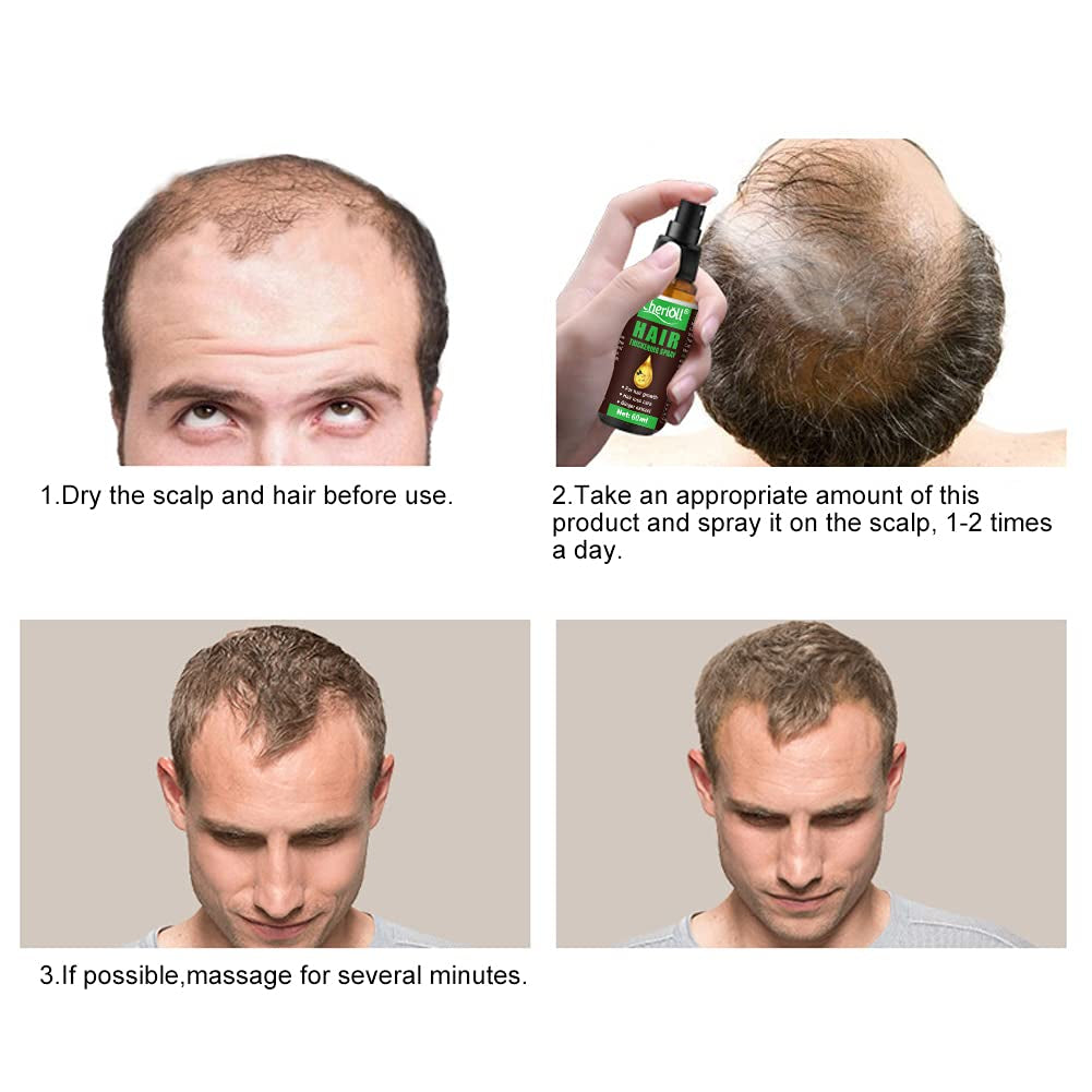 Crecimiento del Cabello, Anticaída, Spray para el Crecimiento del Cabello, Tratamiento y Caída del Cabello, Para Adelgazar el Cabello, Promueve un Crecimiento del Cabello más Grueso, Completo y Rápido, 60ml Cuidado del Cabello Naty Shop