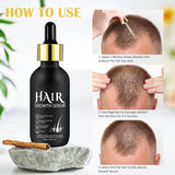 Aceite Orgánico para el Crecimiento del Cabello 5% - Solución de Uso Externo - Crecimiento y Engrosamiento del Cabello - Para la Caída y Afinamiento del Cabello Masculino - Reactiva los Folículos que se Encogen - Dispensador de Bomba Precisa, 60ml Cuidado del Cabello Naty Shop