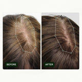 Rutina de crecimiento del cabello de Scandinavian Biolabs para mujeres con resultados clínicamente probados en 45 días | Tratamiento Caída del Cabello (Bio-Pilixin) Naty Shop Hair Care