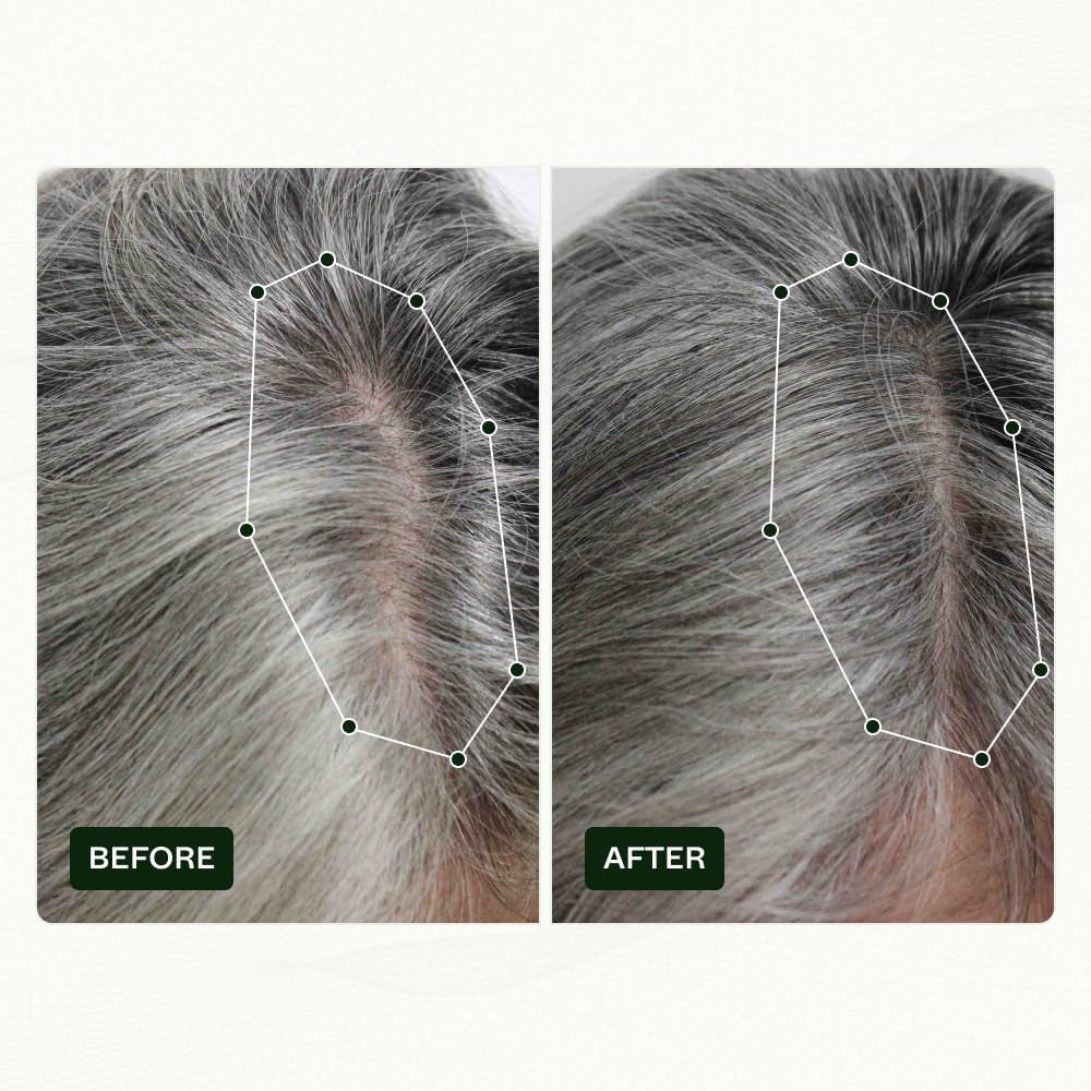 Rutina de crecimiento del cabello de Scandinavian Biolabs para mujeres con resultados clínicamente probados en 45 días | Tratamiento Caída del Cabello (Bio-Pilixin) Naty Shop Hair Care