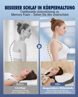 Almohada Cervical Almohada Ortopédica para Dolor de Cuello Almohada Viscoelástica Almohada Ergonómica para un Soporte Óptimo Almohada de Soporte Cervical para Soportes Laterales de Espalda y Abdominales Almohadas Ortopédicas Cervicales Naty Shop