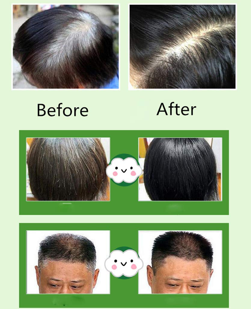 Natural Ingredients Champú instantáneo para tinte de cabello negro, tinte para cabello negro semipermanente, fácil de usar, de larga duración, ingredientes naturales (10 piezas, negro) Naty Shop Hair Dye