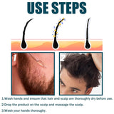 Miioto Suero para el crecimiento del cabello Producto para el crecimiento del cabello para hombres Suero para el crecimiento del cabello Cuidado del cuero cabelludo Promueve un cabello más grueso Nutre el cuero cabelludo Previene la caída del cabello 3*60 ML Cuidado del cabello Naty Shop
