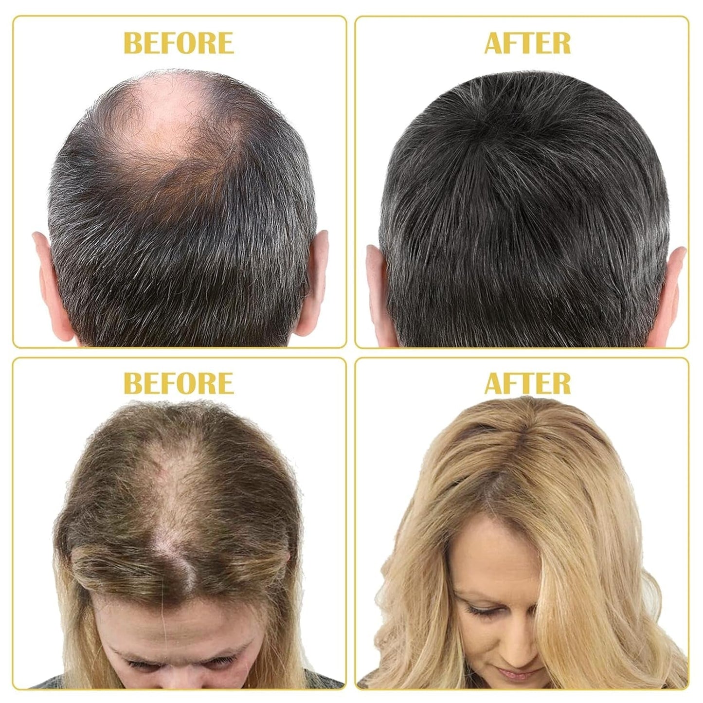 Aceite Orgánico para el Crecimiento del Cabello 5% - Solución de Uso Externo - Crecimiento y Engrosamiento del Cabello - Para la Caída y Afinamiento del Cabello Masculino - Reactiva los Folículos que se Encogen - Dispensador de Bomba Precisa, 60ml Cuidado del Cabello Naty Shop