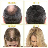 Aceite Orgánico para el Crecimiento del Cabello 5% - Solución de Uso Externo - Crecimiento y Engrosamiento del Cabello - Para la Caída y Afinamiento del Cabello Masculino - Reactiva los Folículos que se Encogen - Dispensador de Bomba Precisa, 60ml Cuidado del Cabello Naty Shop