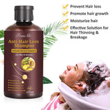 Champú para el crecimiento del cabello, anticaída, champú para la caída del cabello, champú a base de hierbas naturales para un crecimiento más rápido del cabello, loción Naty Shop Hair Care