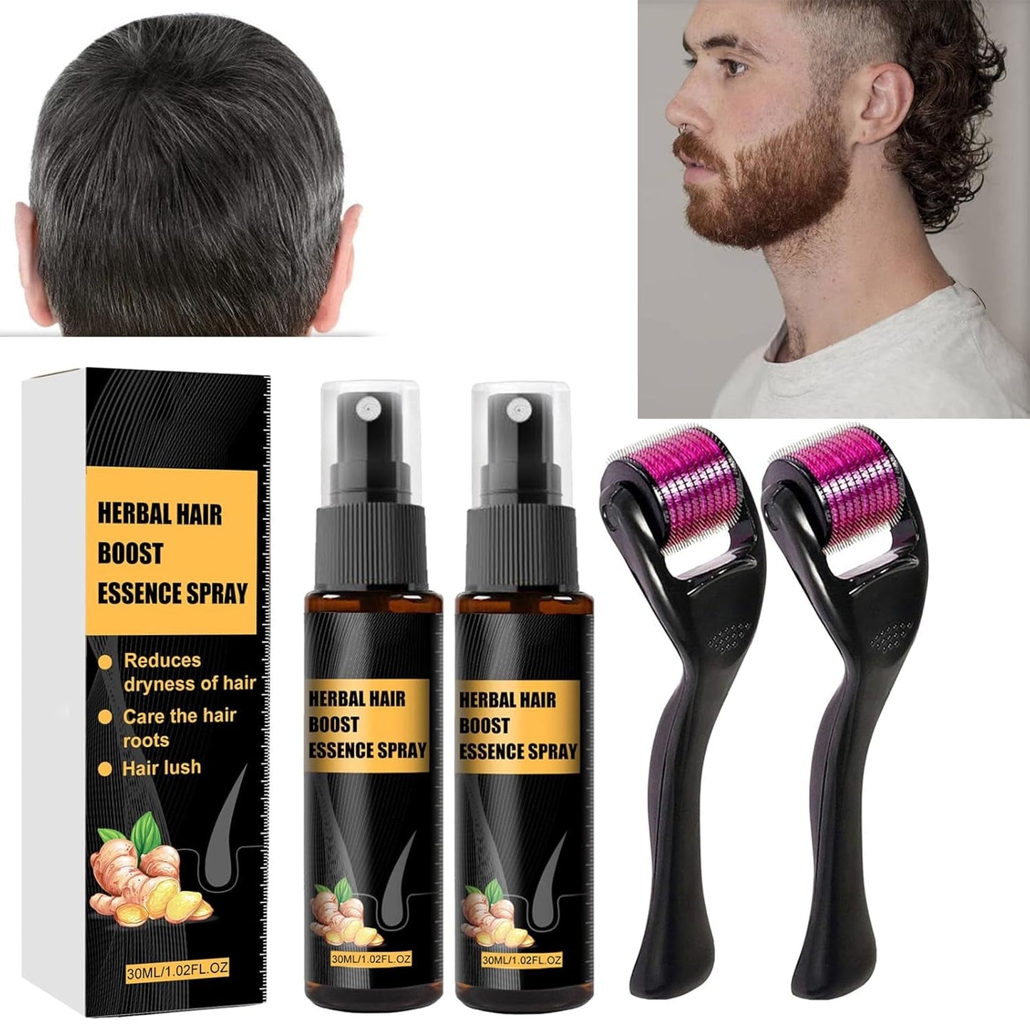 Kit de tratamiento avanzado para el crecimiento del cabello, 30 ml, 2 piezas, spray para el crecimiento del cabello, juego de esencia y rodillo para el crecimiento del cabello, suero para el crecimiento del cabello, antipérdida de cabello, suero avanzado para el crecimiento del cabello, cuidado del cabello, Naty Shop Título predeterminado