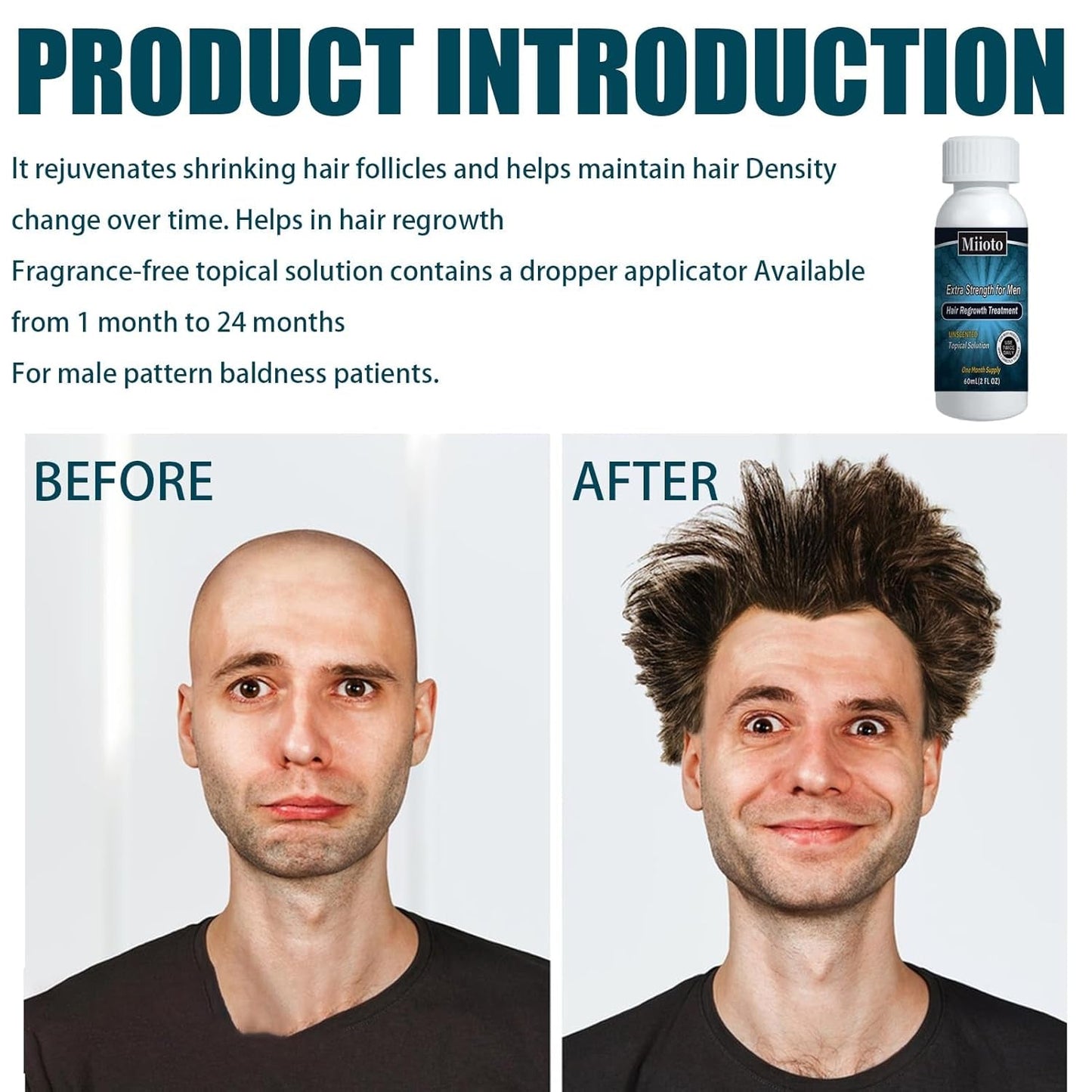 Miioto Suero para el crecimiento del cabello Producto para el crecimiento del cabello para hombres Suero para el crecimiento del cabello Cuidado del cuero cabelludo Promueve un cabello más grueso Nutre el cuero cabelludo Previene la caída del cabello 3*60 ML Cuidado del cabello Naty Shop