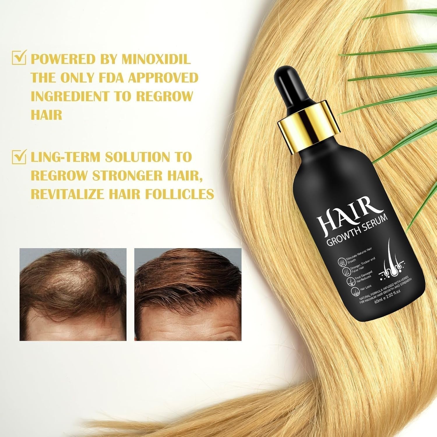 Aceite Orgánico para el Crecimiento del Cabello 5% - Solución de Uso Externo - Crecimiento y Engrosamiento del Cabello - Para la Caída y Afinamiento del Cabello Masculino - Reactiva los Folículos que se Encogen - Dispensador de Bomba Precisa, 60ml Cuidado del Cabello Naty Shop