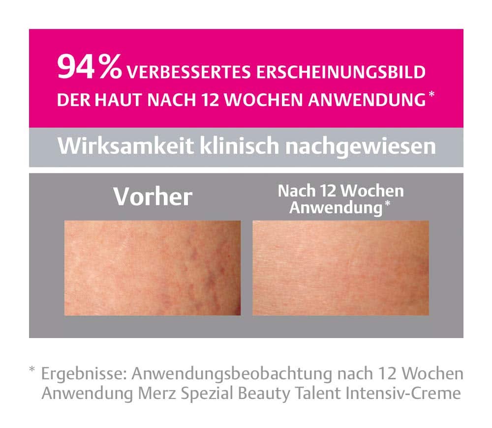 Merz Spezial, Crema intensiva para estrías, 75 ml Cosmética y Belleza Naty Shop