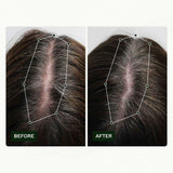 Rutina de crecimiento del cabello de Scandinavian Biolabs para mujeres con resultados clínicamente probados en 45 días | Tratamiento Caída del Cabello (Bio-Pilixin) Naty Shop Hair Care