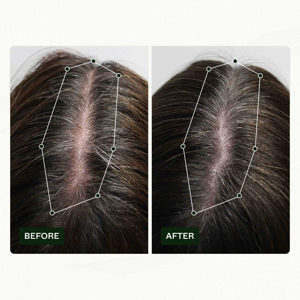 Rutina de crecimiento del cabello de Scandinavian Biolabs para mujeres con resultados clínicamente probados en 45 días | Tratamiento Caída del Cabello (Bio-Pilixin) Naty Shop Hair Care