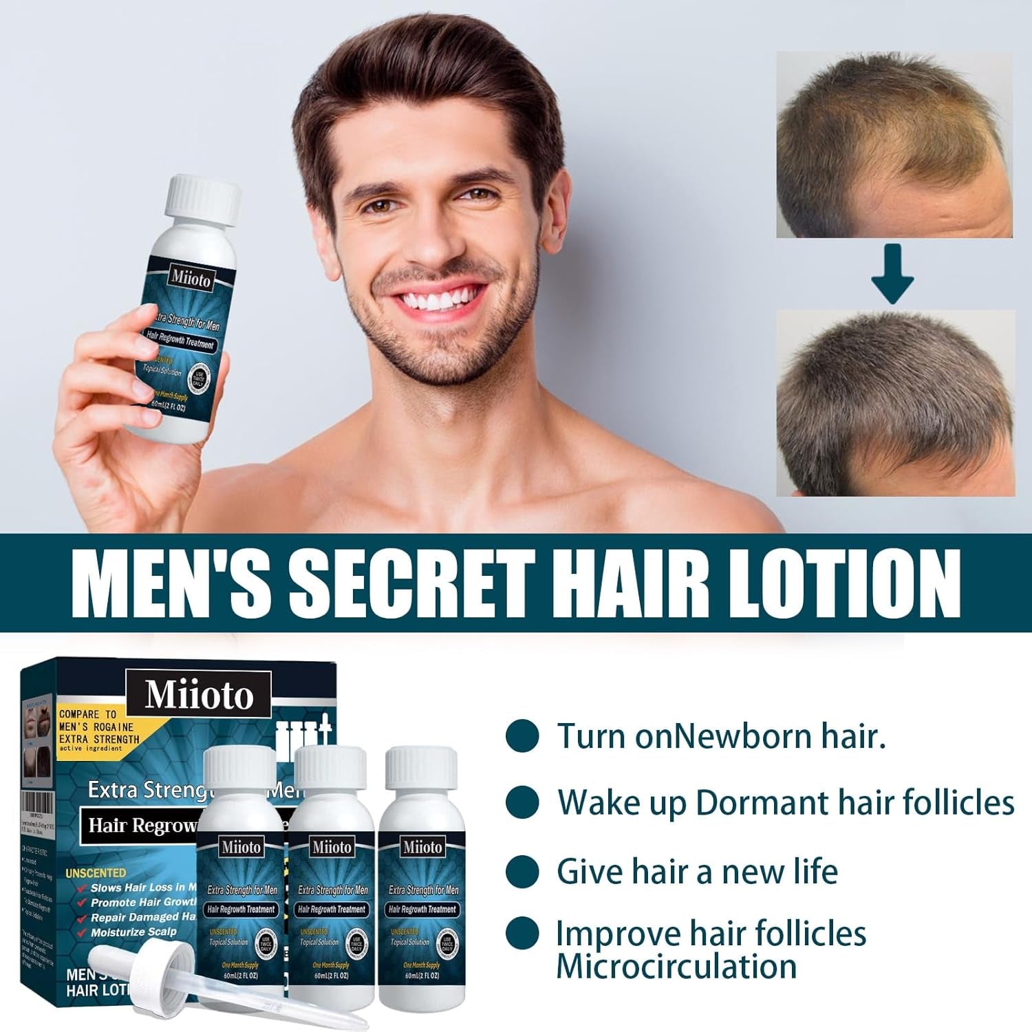 Miioto Suero para el crecimiento del cabello Producto para el crecimiento del cabello para hombres Suero para el crecimiento del cabello Cuidado del cuero cabelludo Promueve un cabello más grueso Nutre el cuero cabelludo Previene la caída del cabello 3*60 ML Cuidado del cabello Naty Shop