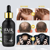 Aceite Orgánico para el Crecimiento del Cabello 5% - Solución de Uso Externo - Crecimiento y Engrosamiento del Cabello - Para la Caída y Afinamiento del Cabello Masculino - Reactiva los Folículos que se Encogen - Dispensador de Bomba Precisa, 60ml Cuidado del Cabello Naty Shop