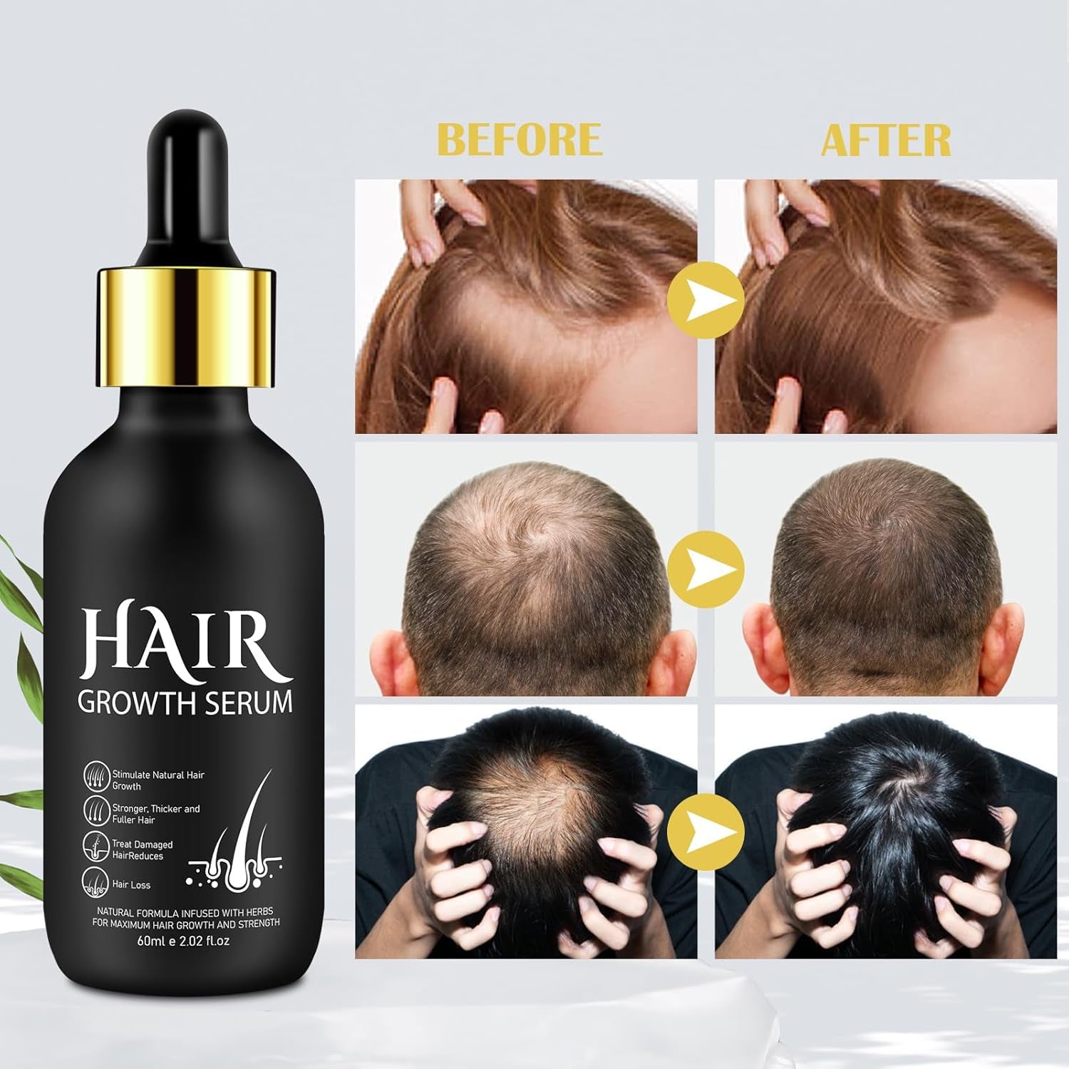 Aceite Orgánico para el Crecimiento del Cabello 5% - Solución de Uso Externo - Crecimiento y Engrosamiento del Cabello - Para la Caída y Afinamiento del Cabello Masculino - Reactiva los Folículos que se Encogen - Dispensador de Bomba Precisa, 60ml Cuidado del Cabello Naty Shop
