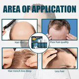 Miioto Suero para el crecimiento del cabello Producto para el crecimiento del cabello para hombres Suero para el crecimiento del cabello Cuidado del cuero cabelludo Promueve un cabello más grueso Nutre el cuero cabelludo Previene la caída del cabello 3*60 ML Cuidado del cabello Naty Shop