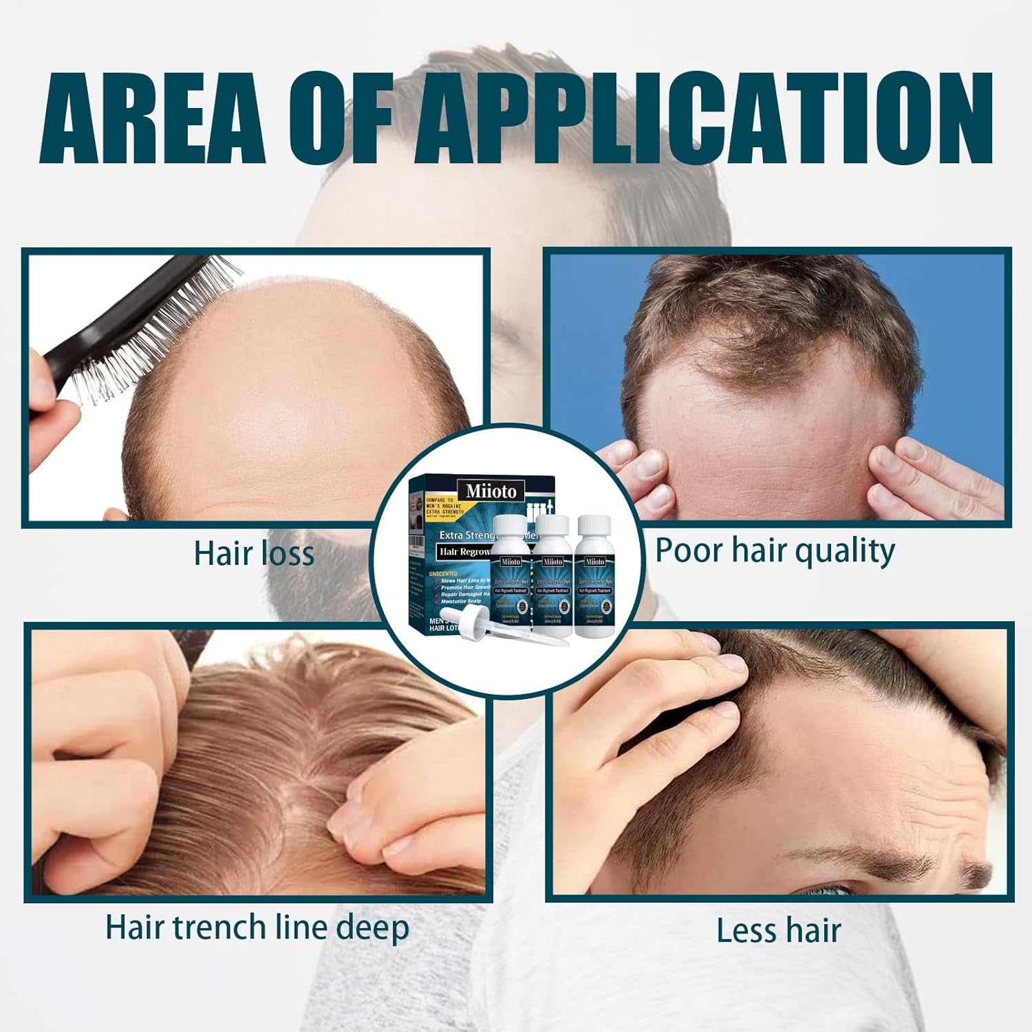 Miioto Suero para el crecimiento del cabello Producto para el crecimiento del cabello para hombres Suero para el crecimiento del cabello Cuidado del cuero cabelludo Promueve un cabello más grueso Nutre el cuero cabelludo Previene la caída del cabello 3*60 ML Cuidado del cabello Naty Shop