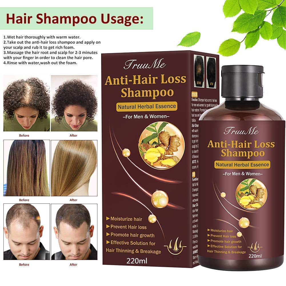 Champú para el crecimiento del cabello, anticaída, champú para la caída del cabello, champú a base de hierbas naturales para un crecimiento más rápido del cabello, loción Naty Shop Hair Care