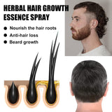 Kit de tratamiento avanzado para el crecimiento del cabello 30ml 2PCS Spray para el crecimiento del cabello Juego de esencia y rodillo para el crecimiento del cabello Suero para el crecimiento del cabello Anticaída Suero avanzado para el crecimiento del cabello Cuidado del cabello Naty Shop