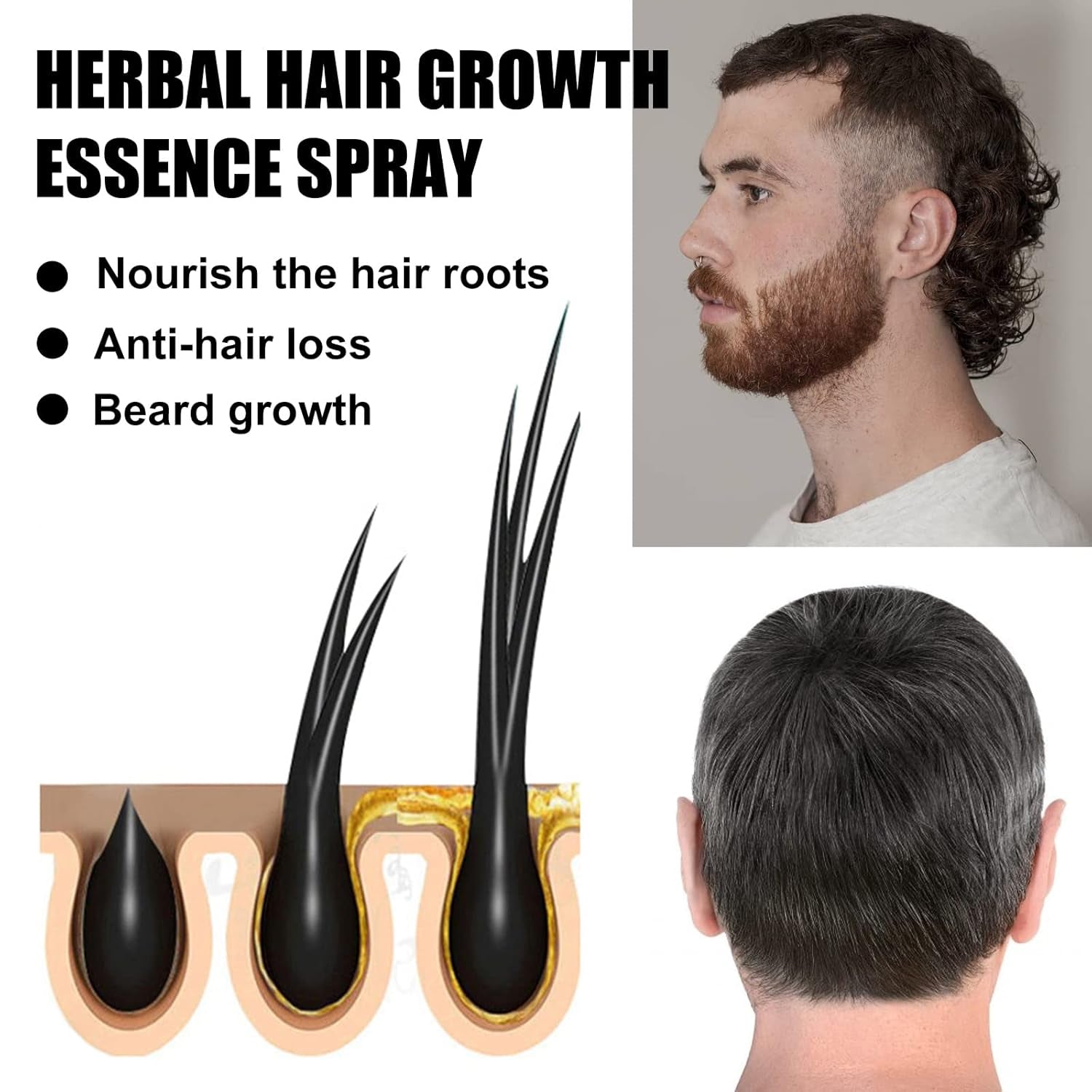 Kit de tratamiento avanzado para el crecimiento del cabello 30ml 2PCS Spray para el crecimiento del cabello Juego de esencia y rodillo para el crecimiento del cabello Suero para el crecimiento del cabello Anticaída Suero avanzado para el crecimiento del cabello Cuidado del cabello Naty Shop