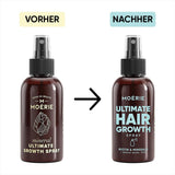 MOÉRIE Ultimate Mineral Hair Growth Spray para cabello más largo, más grueso y con más volumen - con biotina y cafeína - Productos para el cabello veganos, sin parabenos, todo tipo de cabello, revierte la caída del cabello - Suministro para 2 meses Cuidado del cabello Naty Shop